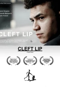  Заячья губа 